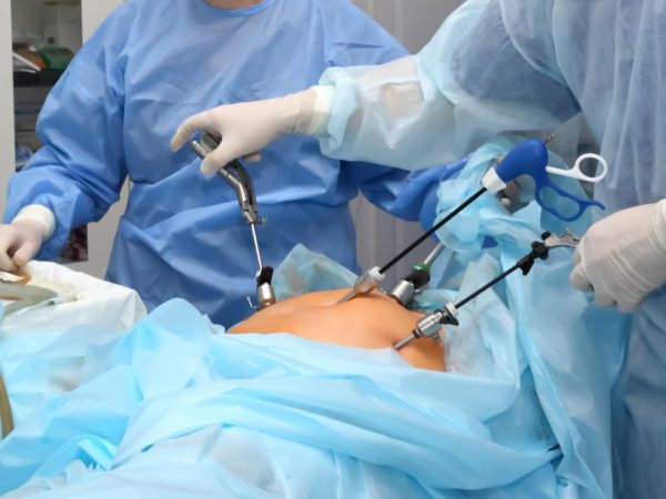 Robotic vs Traditional Laparoscopy: Which Approach is Superior?